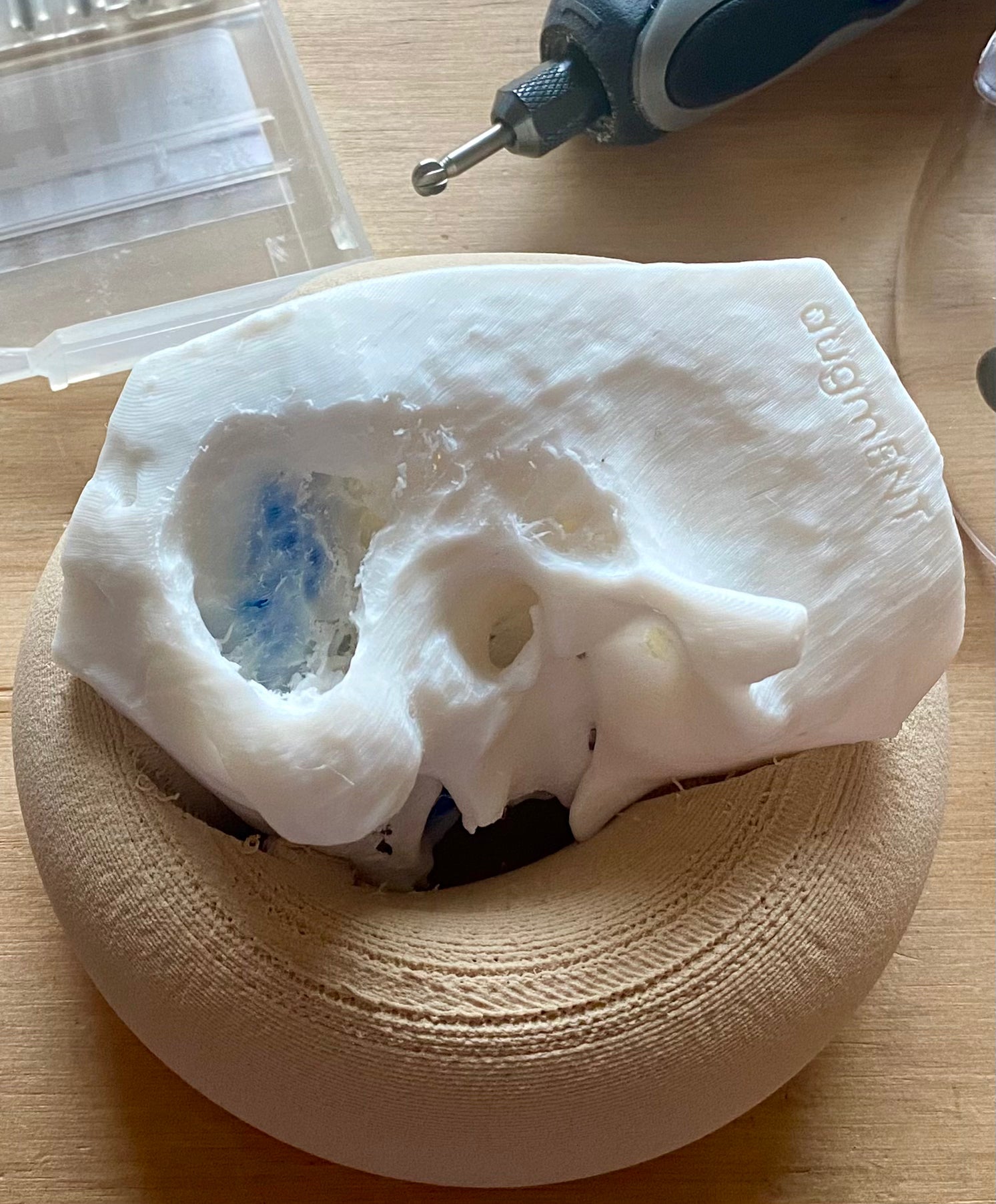 AugmENT's custom fitted 3D printed temporal bone holder lets you start drilling right away.