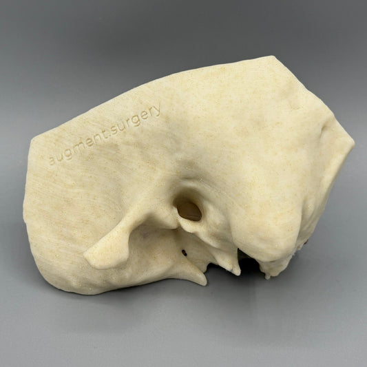 Delta-Left OpenEar 3D Temporal Bones