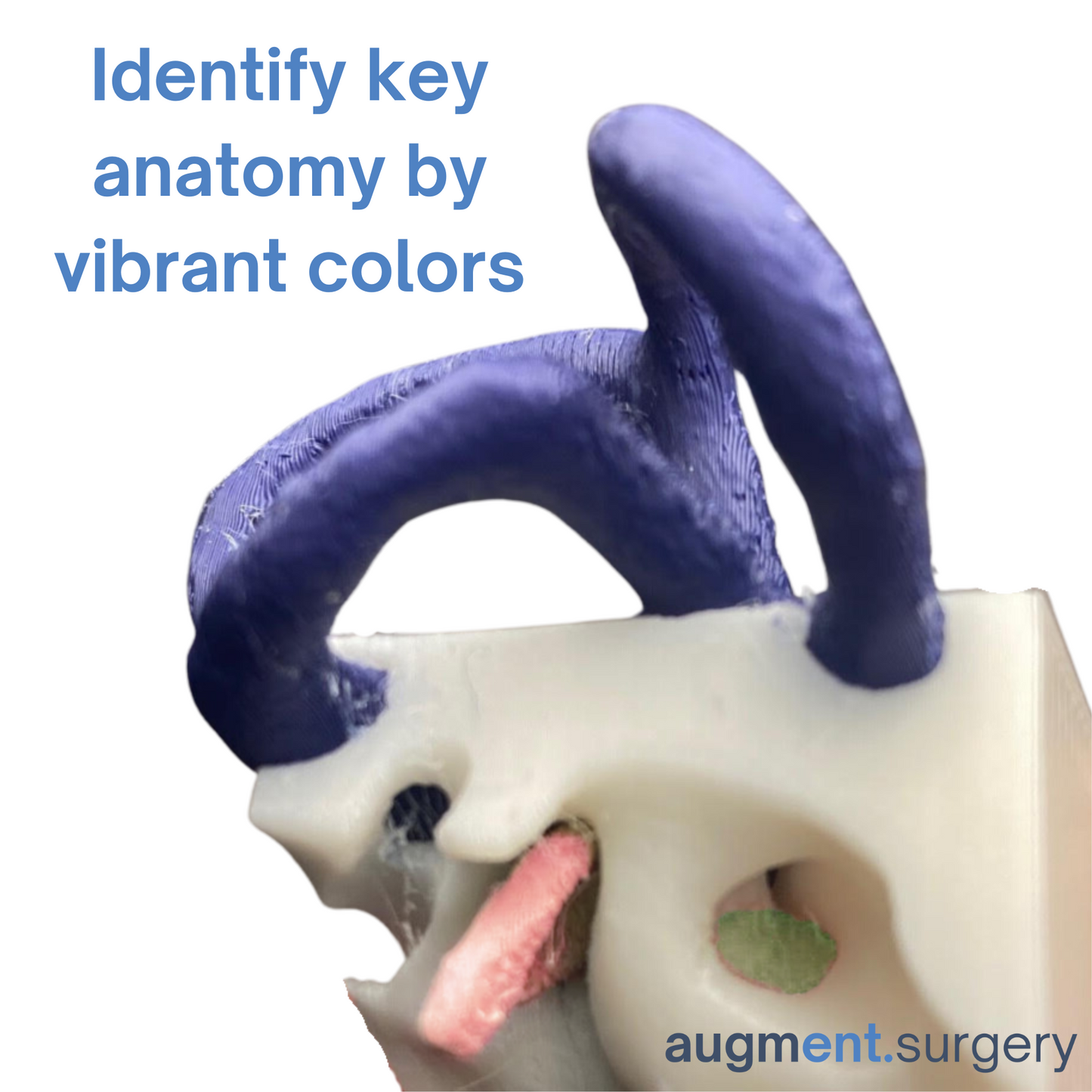 *High Contrast Colors* 3D Temporal Bones to Introduce Anatomy (6-pack)