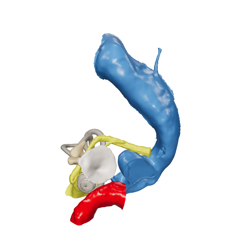 Temporal bone anatomy for OpenEar Delta-Left, remixed by Augment Surgery.