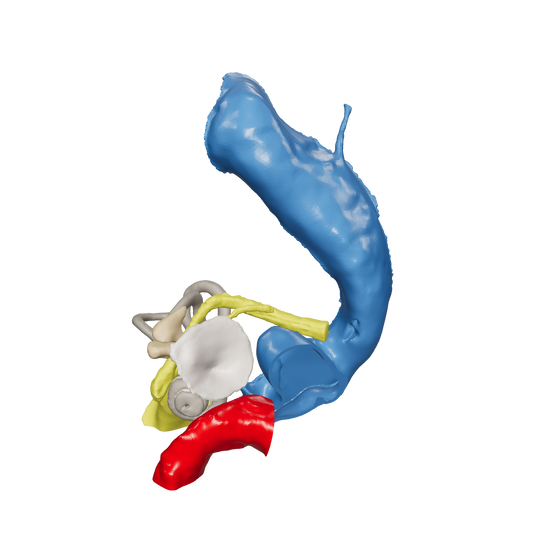 Temporal bone anatomy for OpenEar Delta-Left, remixed by Augment Surgery.