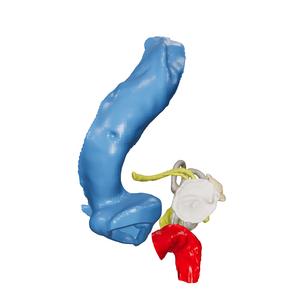 Temporal bone anatomy for OpenEar Gamma-Right, remixed by Augment Surgery.