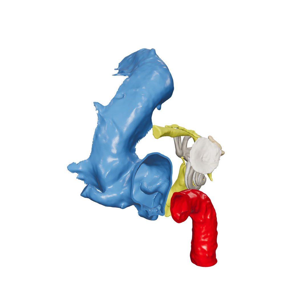 Temporal bone anatomy for OpenEar Theta-Right, remixed by Augment Surgery.