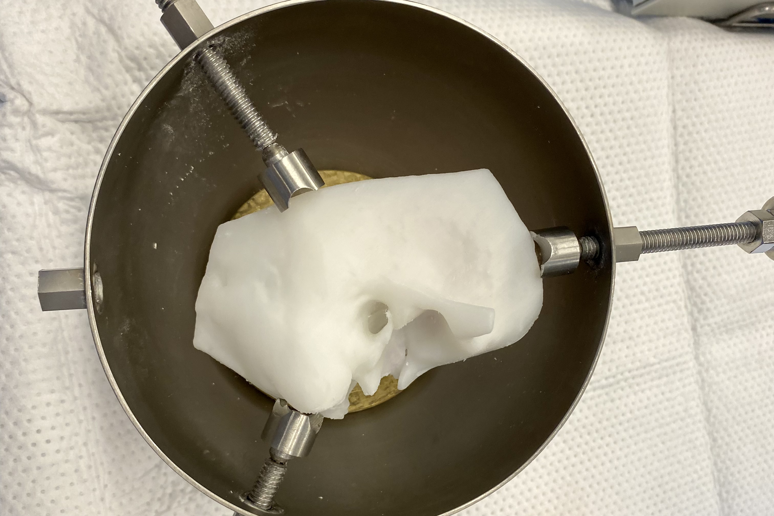 Life-like 3D printed temporal bone from OpenEar Delta dataset in a bone holder and ready to drill.