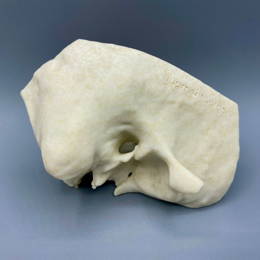 Delta-Right OpenEar 3D Temporal Bones