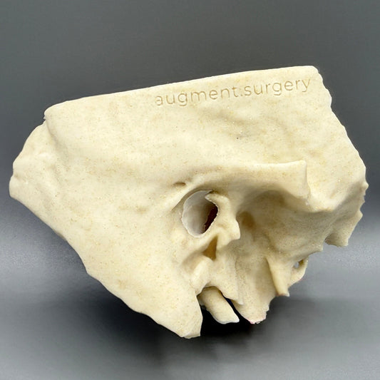 Epsilon-Right OpenEar 3D Temporal Bones