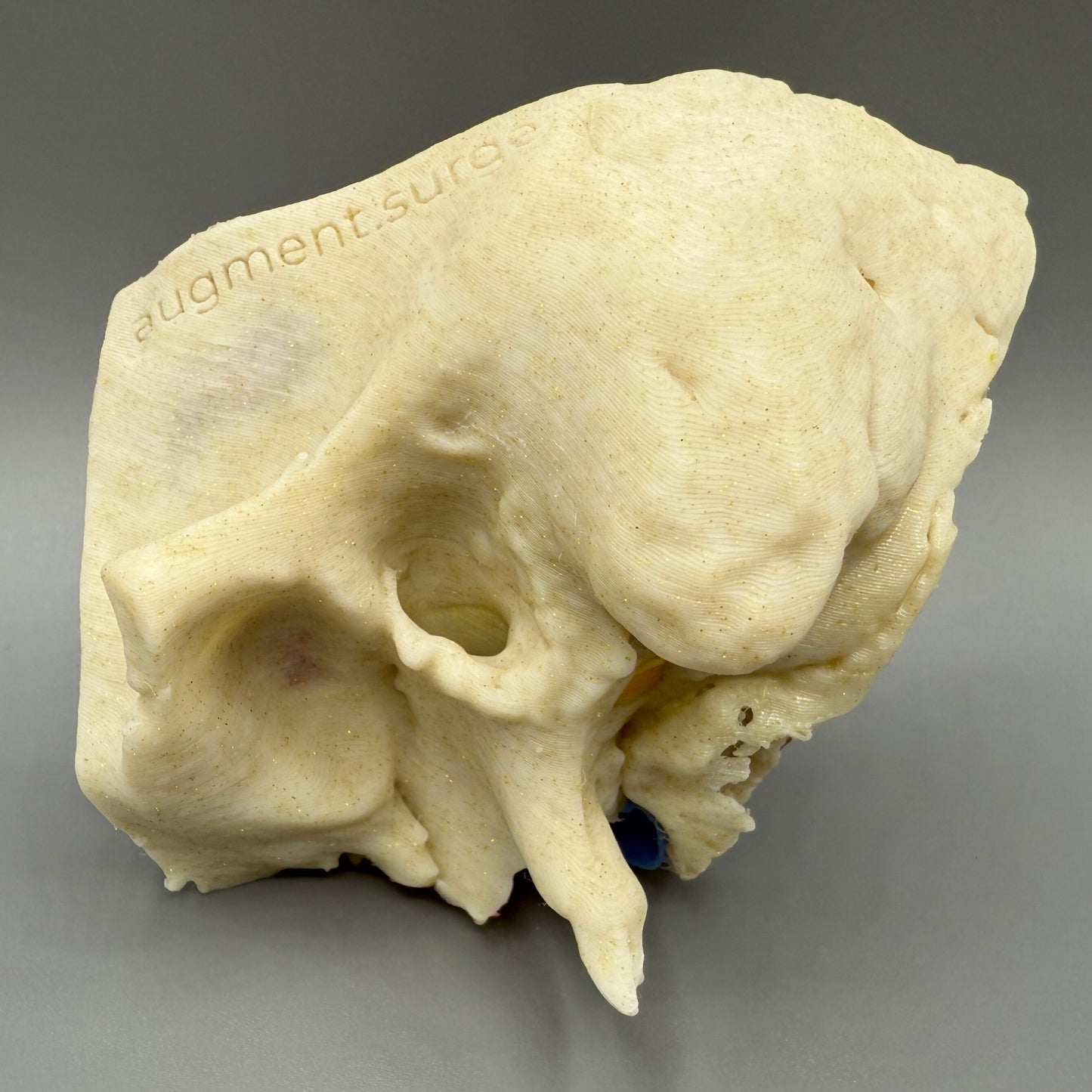 Eta-Left OpenEar 3D Temporal Bones