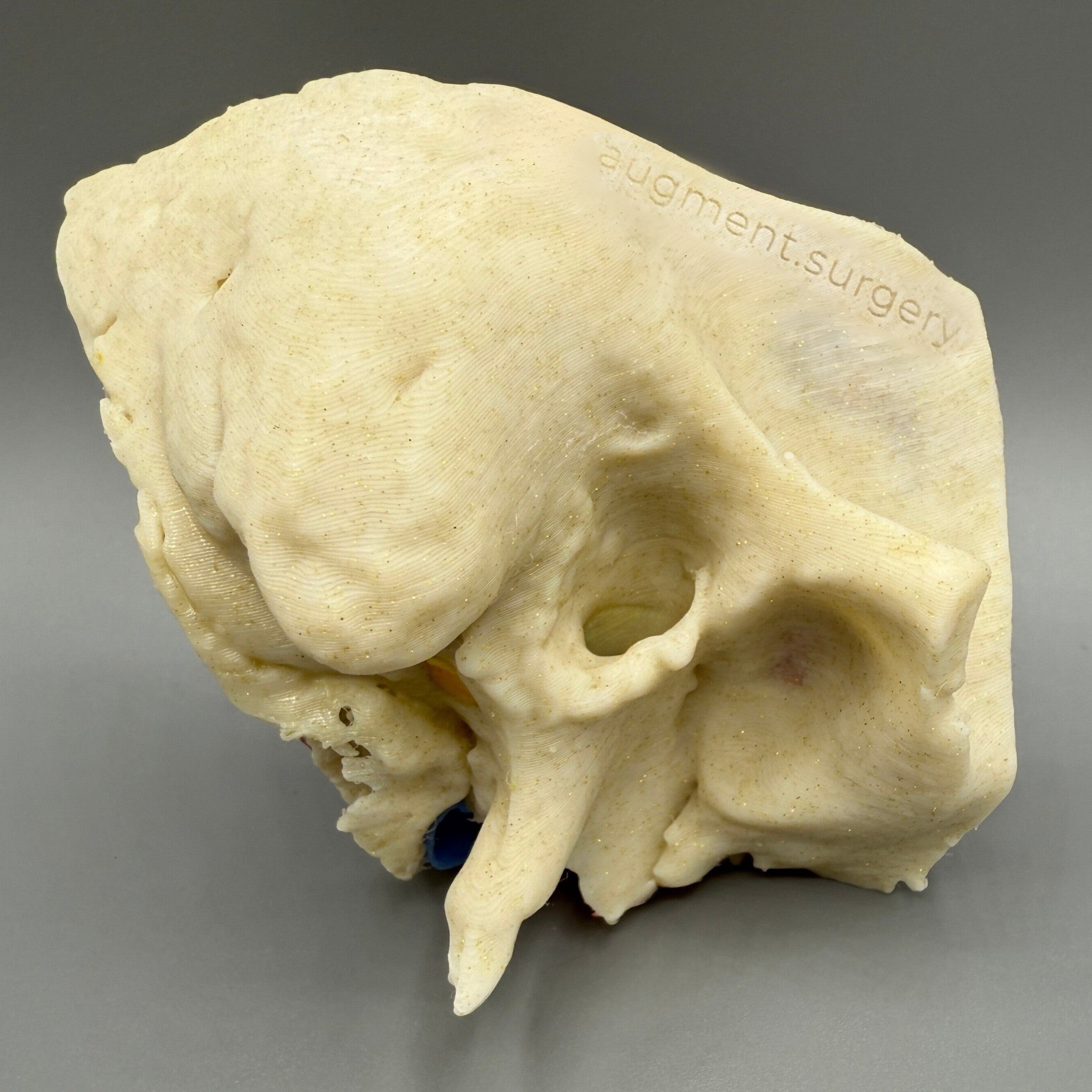 Temporal The 3D Temporal Bone Collection - 12+ Surgical Simulators – Augment Surgery