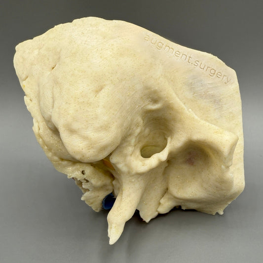 Eta-Right OpenEar 3D Temporal Bones