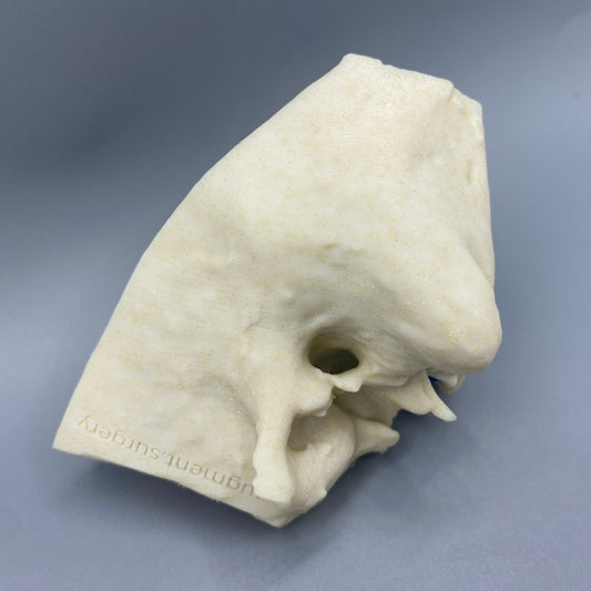 Gamma-Left OpenEar 3D Temporal Bones