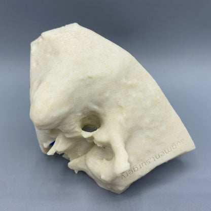 Gamma OpenEar Temporal Bones