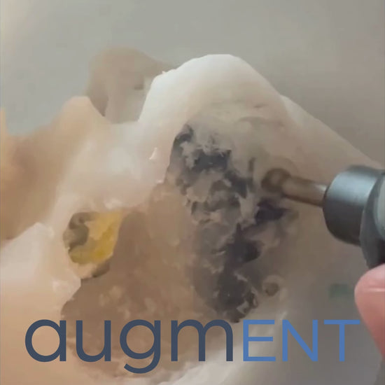 Drilling on 3D printed AugmENT temporal bone with portable dissection kit without irrigation.