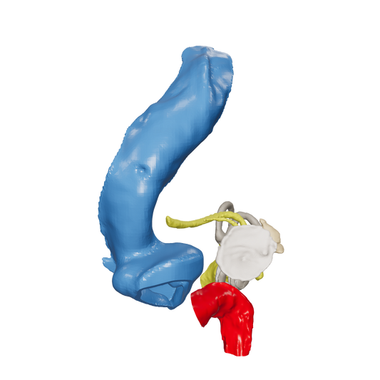 Temporal bone anatomy for OpenEar Gamma-Right, remixed by Augment Surgery.