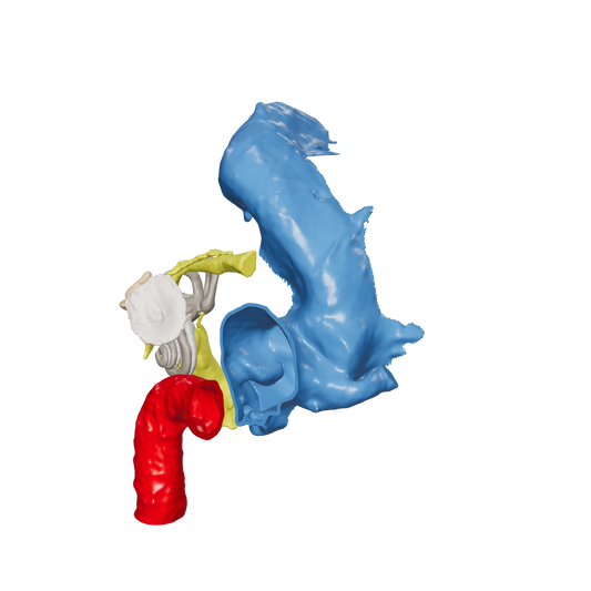 Temporal bone anatomy for OpenEar Theta-Left, remixed by Augment Surgery.
