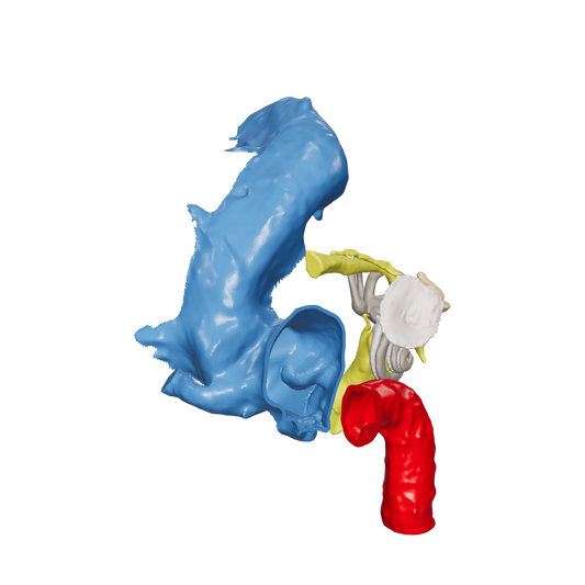 Temporal bone anatomy for OpenEar Theta-Right, remixed by Augment Surgery.