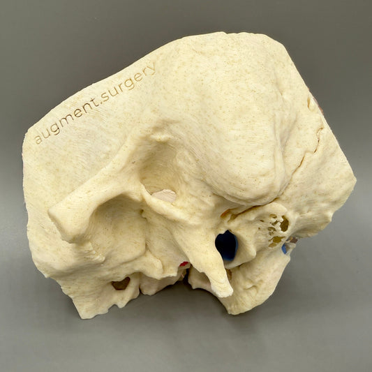 Theta-Left OpenEar 3D Temporal Bones
