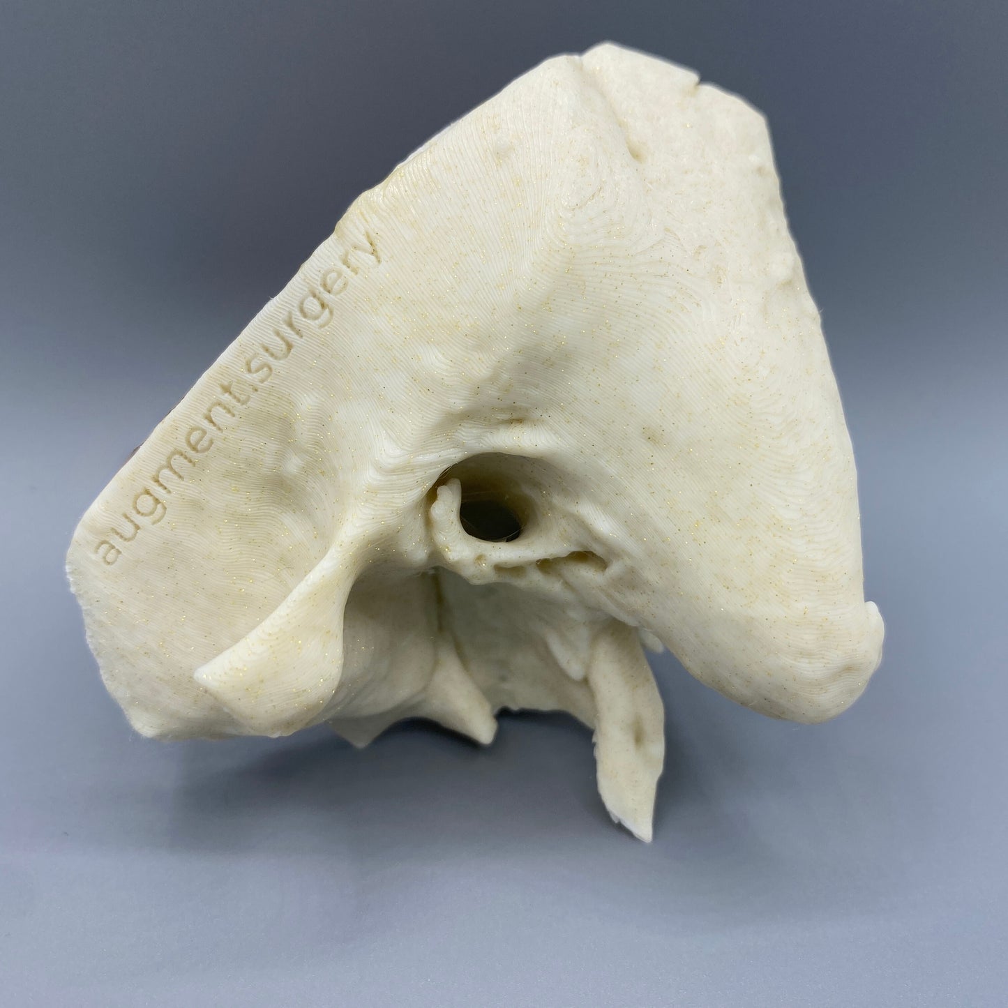 Zeta-Left OpenEar 3D Temporal Bones