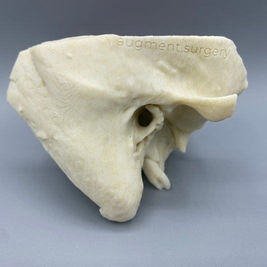 Zeta OpenEar Temporal Bones