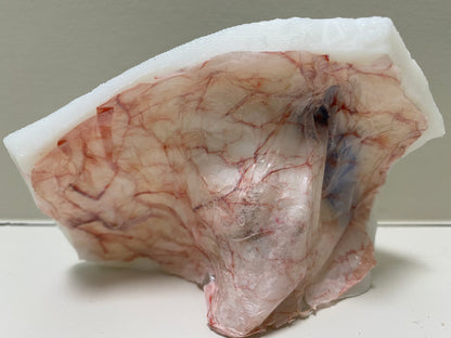 Simulated dura mater covers the medial fossa and helps surgeons identify and approach the tegmen.